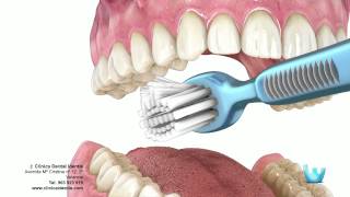 Higiene dental  Clinica identis [upl. by Netsruk113]