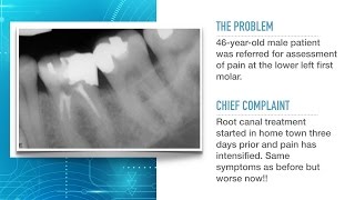 Advances in Endodontic Treatment Part 1Diagnosis and Treatment Planning [upl. by Eiramanin]