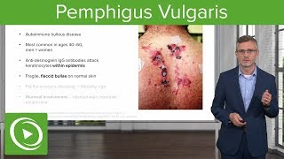 Pemphigus Vulgaris – Dermatology  Lecturio [upl. by Nathanil]