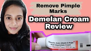 Demelan Cream  Precautions Review [upl. by Sitoeht]