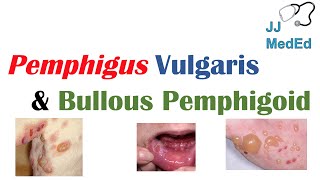 Vesiculobullous Skin Diseases  Pemphigus Vulgaris vs Bullous Pemphigoid [upl. by Butler]