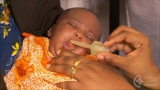 Preparing and Giving Oral Amoxicillin  Newborn Care Series [upl. by Garvey]