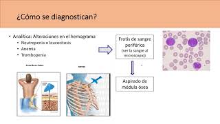 Leucemia síntomas diagnóstico y tratamiento  Su Médico en Casa [upl. by Nytsyrk]