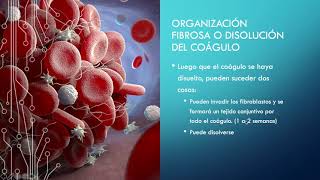 HEMOSTASIA y COAGULACIÓN SANGUÍNEA  GUYTON FISIOLOGÍA [upl. by Edaj]