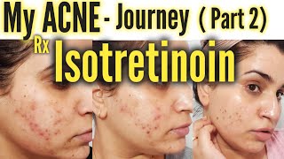 My Acne Journey Part 2  Isotretinoin [upl. by Kaltman]