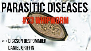 Parasitic Diseases Lectures 23 Whipworm [upl. by Sukey]