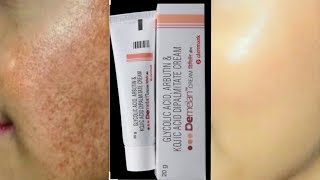 Demelan cream Remove pigmentation Acne scars pimple marks [upl. by Milas]