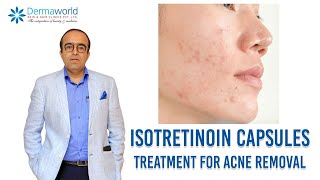 Isotretinoin capsules  Treatment for Acne removal  In Hindi  Dr Rohit Batra [upl. by Seedman]