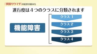 関節リウマチの症状の進み方（解説あり）（湯川リウマチ内科クリニック湯川宗之助院長解説） [upl. by Alrats]