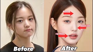 Ive Wonyoung EXTREME plastic surgery [upl. by Novart]