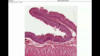 Anatomy  Histology of the Stomach amp Small Intestine [upl. by Asselem]