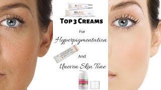 Top 3 Creams For Hyperpigmentation Uneven Skin Tone and Dull Skin  Rabia Skin Care [upl. by Lyontine212]