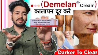 Demelan Cream Review  How to Use Demelan Cream  Sahil Nagpal [upl. by Abeu]