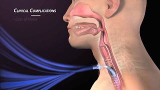 Tracheostomy Trach Care Overview Nursing Skills [upl. by Noorah]