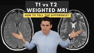 T1 vs T2 weighted MRI images How to tell the difference [upl. by Guimond231]