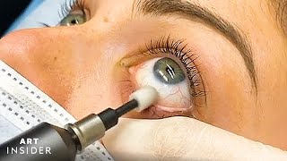 Eyelid Microexfoliation Cleanses Your Eyes [upl. by Inot]