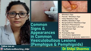 Signs in common Vesiculobullous Lesions Pemphigus amp Pemphigoids [upl. by Ninazan121]