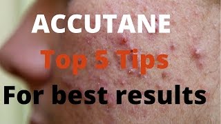 Accutane 5 tips by Dermatologists [upl. by Ahsiadal885]