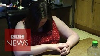 Narcolepsy What is it like to have a cataplexy attack  BBC News [upl. by Durham]