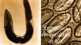 Entrobius vermicularis Pin Worm under microscope at 40 X [upl. by Elliven]