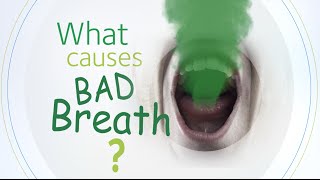 What Causes Bad Breath [upl. by Htiffirg]