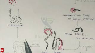 Trichuriasis  Whipworm structure Life cycle Symptoms and treatment  Bio science [upl. by Marienthal]