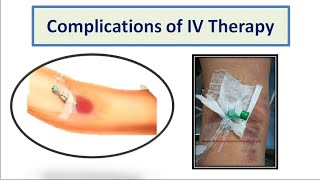 Complications of IV Therapy [upl. by Annavahs436]