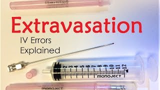 Extravasation  IV Infiltration Errors Explained Doctor Interview [upl. by Leese]