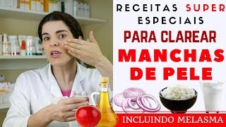 Acabe com as MANCHAS NA PELE inclusive MELASMA  Receita Caseira [upl. by Eisnyl201]