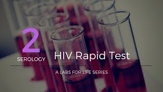 HIV Rapid Test [upl. by Pathe305]