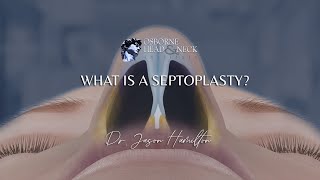 How To Survive A Septoplasty  What I Wish I Knew [upl. by Shivers868]