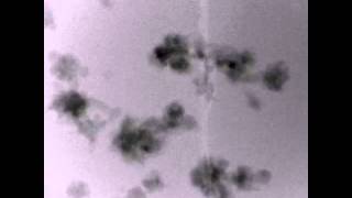 Lithium dendrite formation [upl. by Recha677]