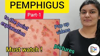 SKIN LESIONS PEMPHIGUS PART1 [upl. by Teeniv]