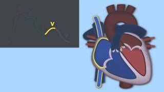 Interpreting Central Venous Pressure Waveforms by J DiNardo  OPENPediatrics [upl. by Bink614]